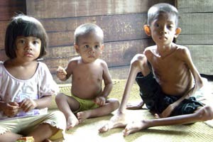 Children suffering from hunger in East Nusa Tenggara | Photo Courtesy of EraMuslim