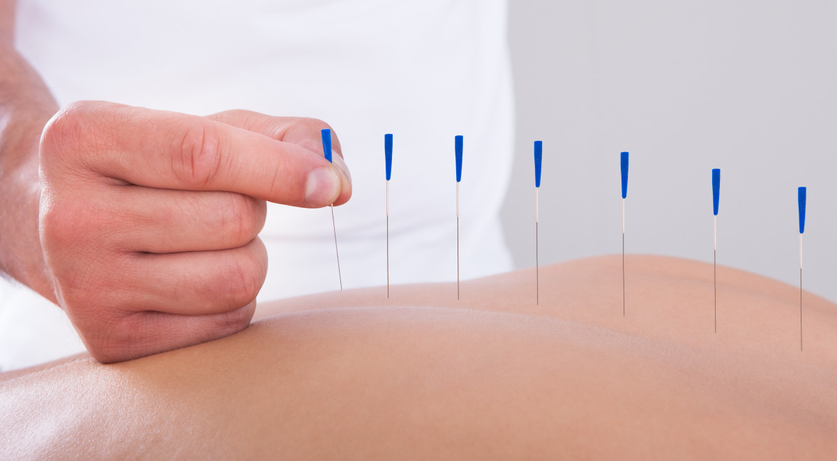 akupunktur slimming jakarta barat