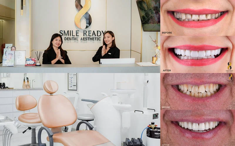 Smile Ready Dental Aesthetic
