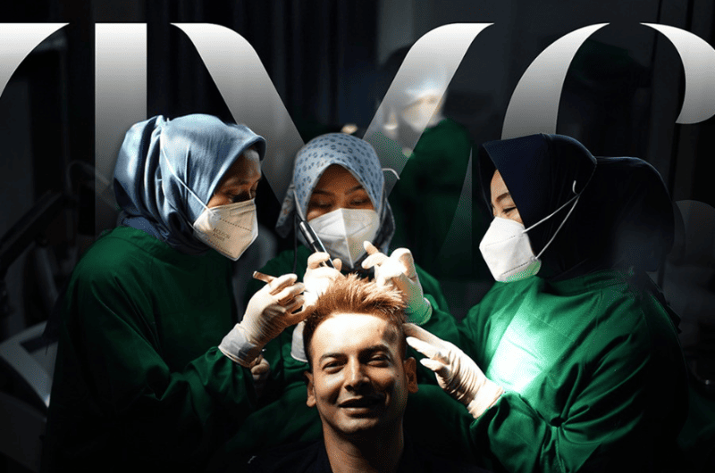 Hair Transplant