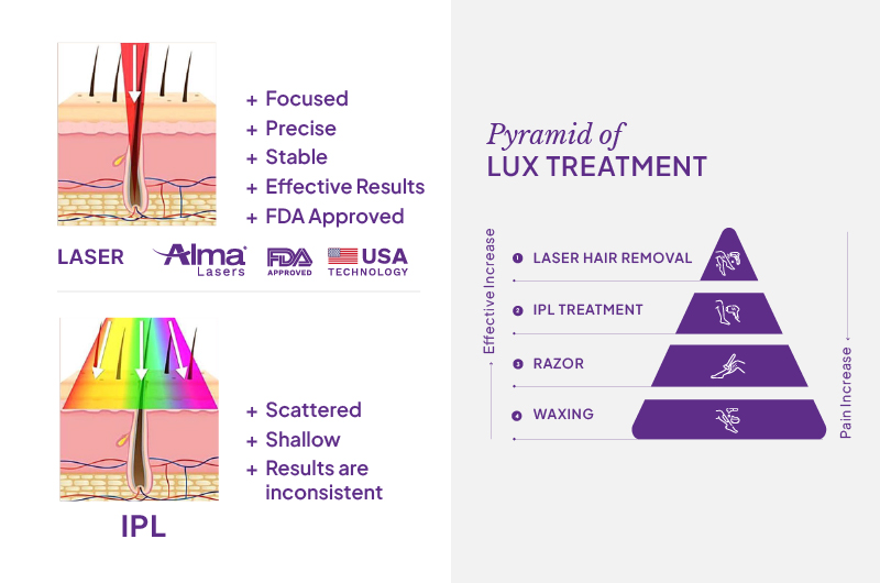 De-Hair Laser and Aesthetics