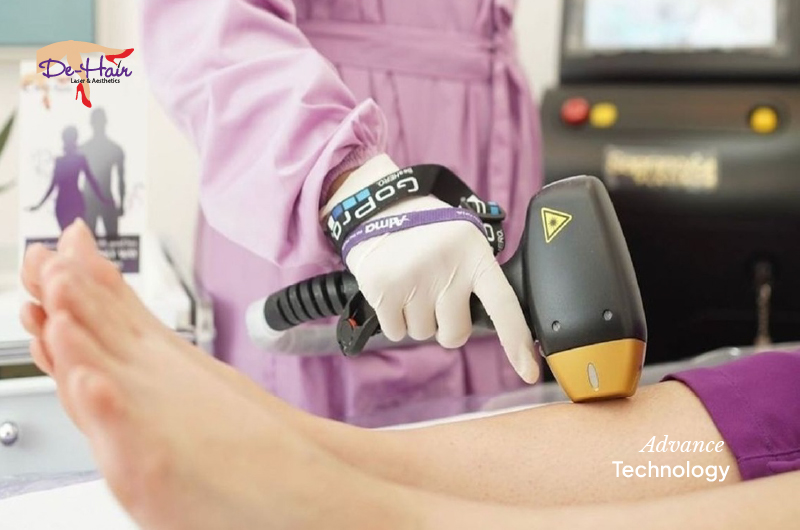 Hair Removal Treatment by Using Advance Technology