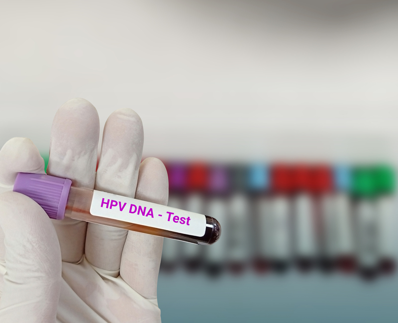 Effective Early Detection of Cervical Cancer: The HPV DNA Test