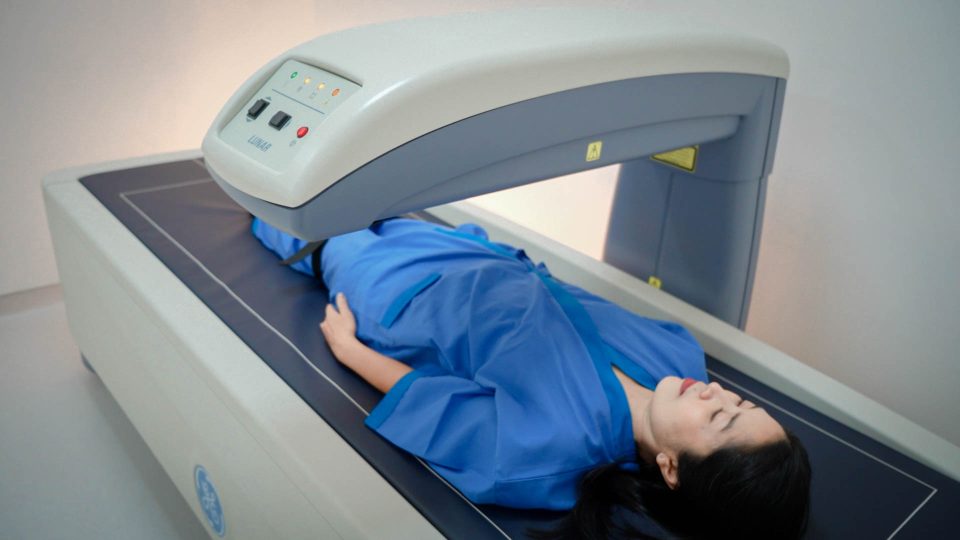 Bone Mineral Densitometry (BMD): Early Detection of Fracture Risk